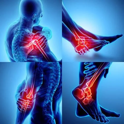 Physiotherapy assessment for joint pain and stiffness