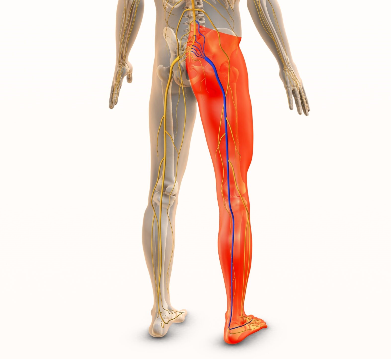 Physiotherapy assessment for sciatica and leg pain