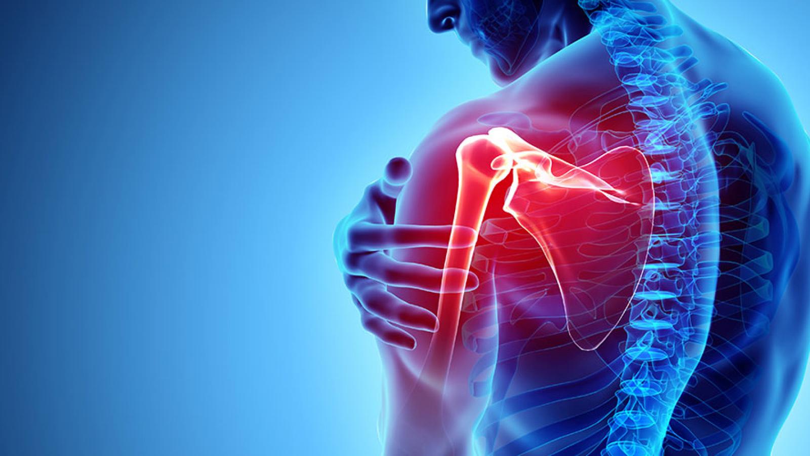 Physiotherapist assessing shoulder pain in Zirakpur